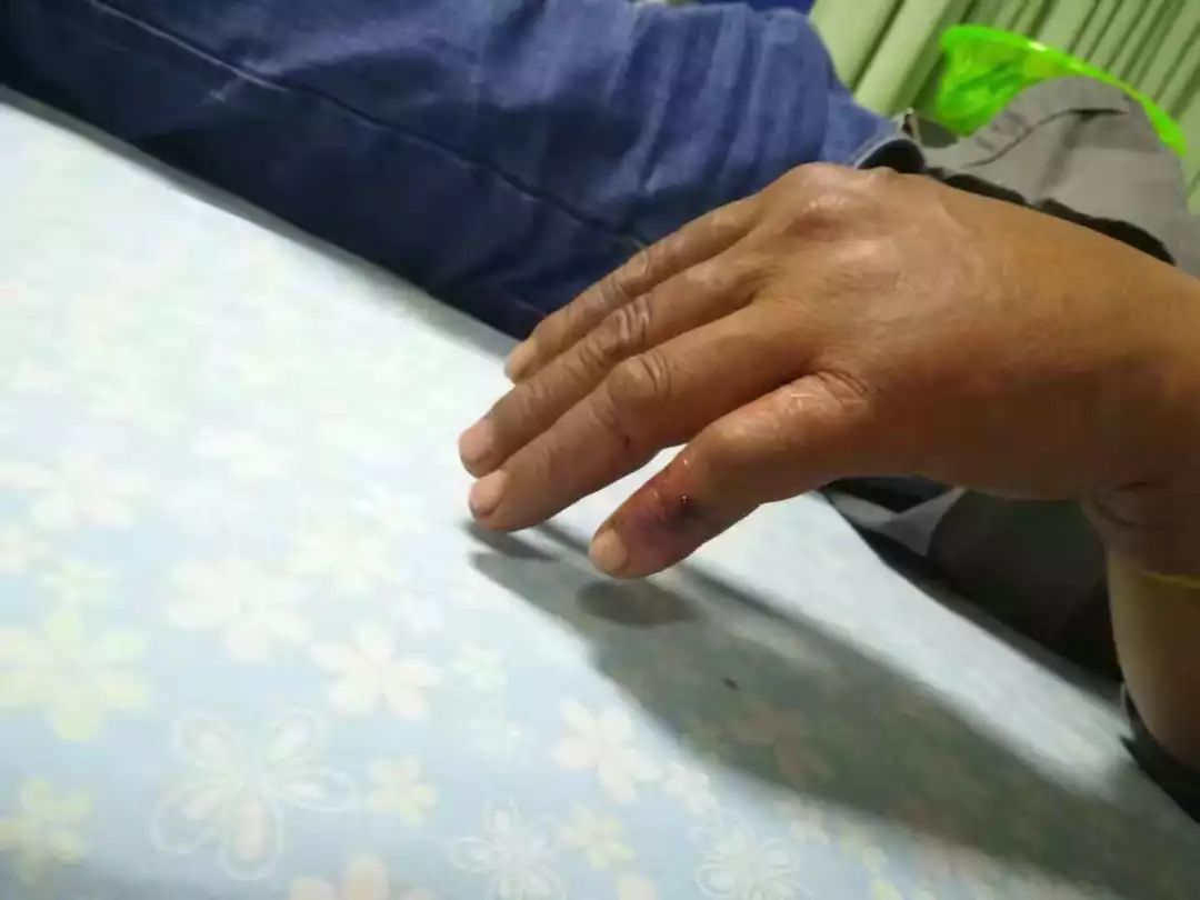 大蟒蛇视频大型挖掘机,工地挖机挖出一条巨蟒