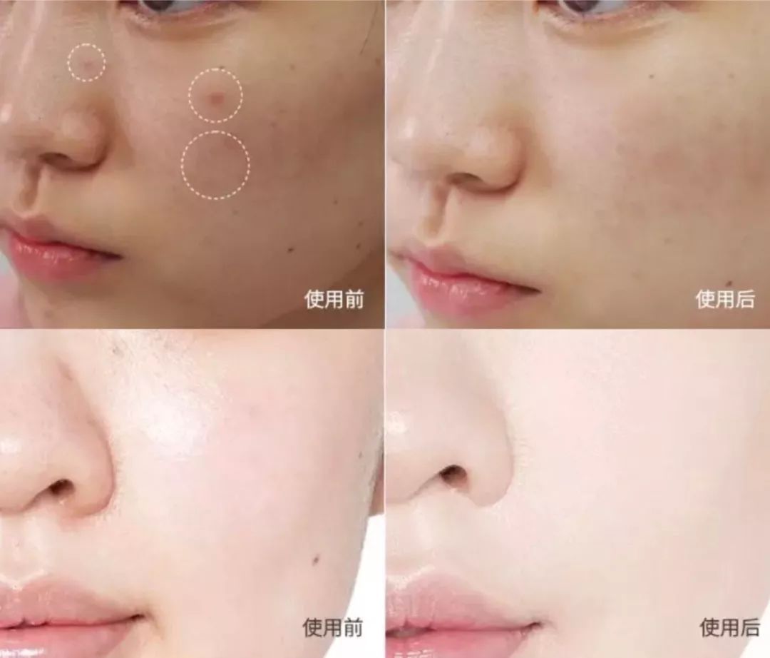 十大好用保湿抗皱精华,十大胶原蛋白护肤品