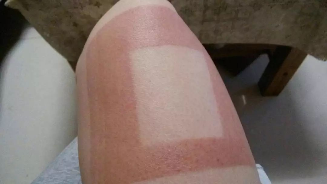 肩颈病用什么贴膏效果好,肩颈疼痛用日本什么膏药好