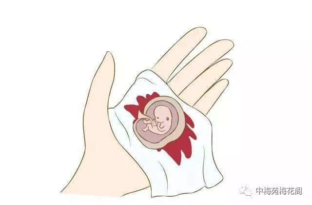 女性避孕技术,医学最安全最有效的避孕方式