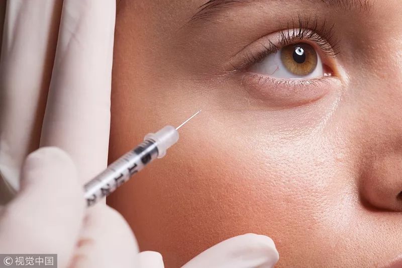 去掉眼袋之后天壤之别,无美颜无滤镜遮泪沟眼袋