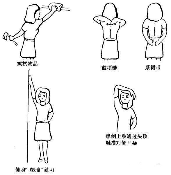 乳腺癌小叶癌手术恢复快,乳腺癌化疗后手肿胳膊肿怎么回事