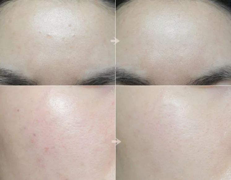 燕窝玻尿酸童颜面膜,玻尿酸燕窝面膜