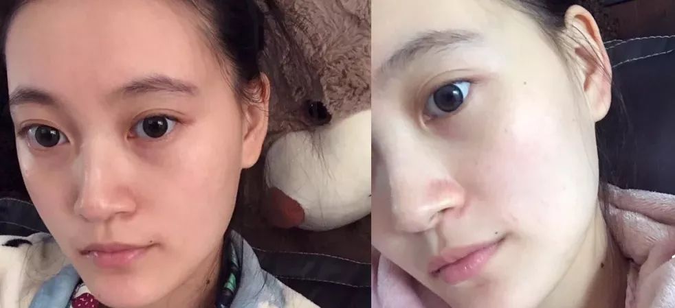 能治黑眼圈的好物推荐,有什么去黑眼圈的平价好物