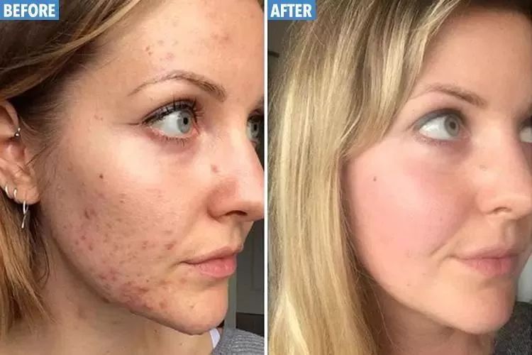 清凉止痒防暑醒神膏,止痒的草药膏