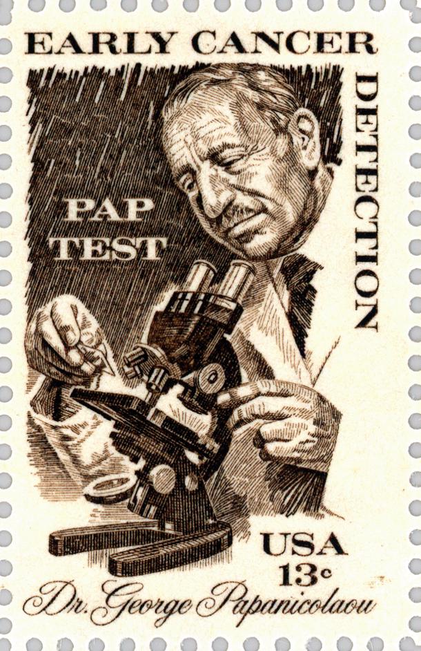 如何看懂宫颈刮片检验单,宫颈刮片报告怎么看