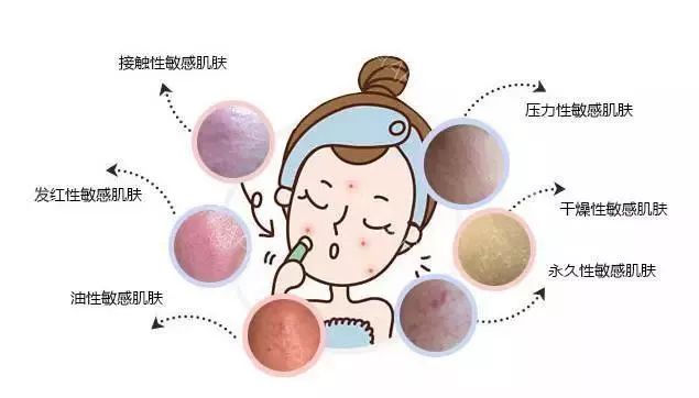 冬季皮肤容易发痒红肿？想要好皮肤，赶紧扔掉手中的洗面奶！