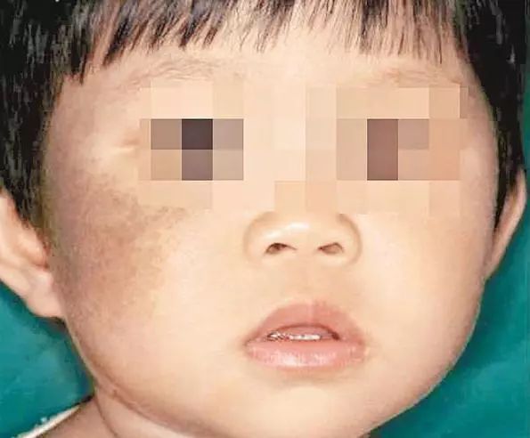 欧诗漫美白淡斑和净白淡斑的区别,真正有效的美白淡斑