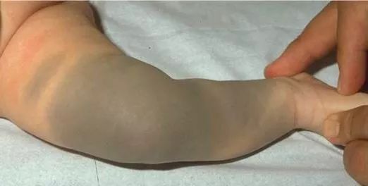 欧诗漫美白淡斑和净白淡斑的区别,真正有效的美白淡斑