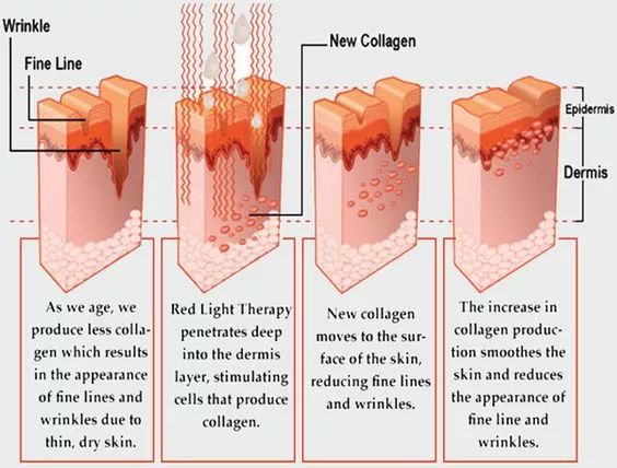 又是激凸又是露底，“蜜桃肌”的盛世美颜也有翻车时