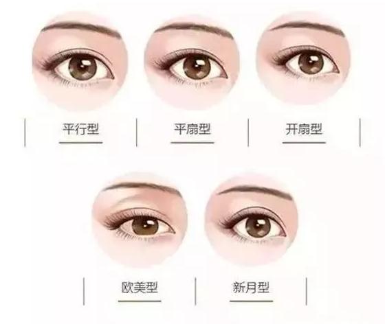 郑州哪家整形医院正规双眼皮,郑州美莱美容医院双眼皮