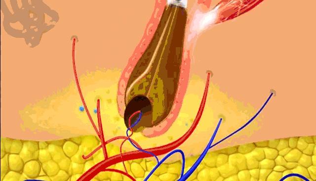 头上又油又有头皮屑又痒怎么办,头上又痒又油有头屑