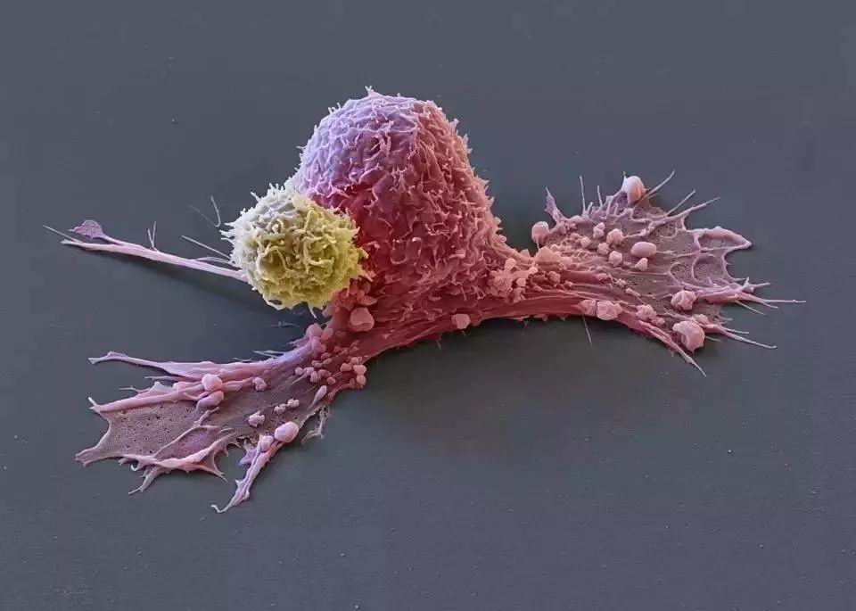 死于癌症后细胞永生,死于癌症