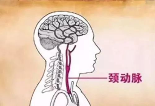 中医治疗心血管狭窄专家教授,倪海厦讲颈部血管狭窄的治疗方法