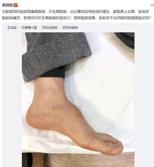 黄晓明增高鞋垫是真的吗,黄晓明增高鞋垫
