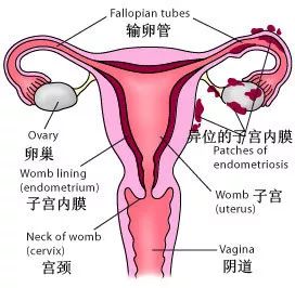 口服“他莫昔芬”子宫内膜增厚怎么办？