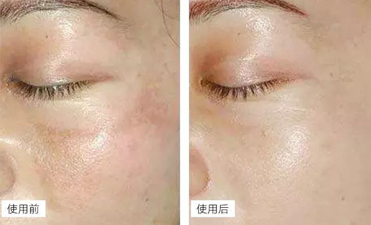 秋天必备的4款单品鞋,秋天穿的小白鞋