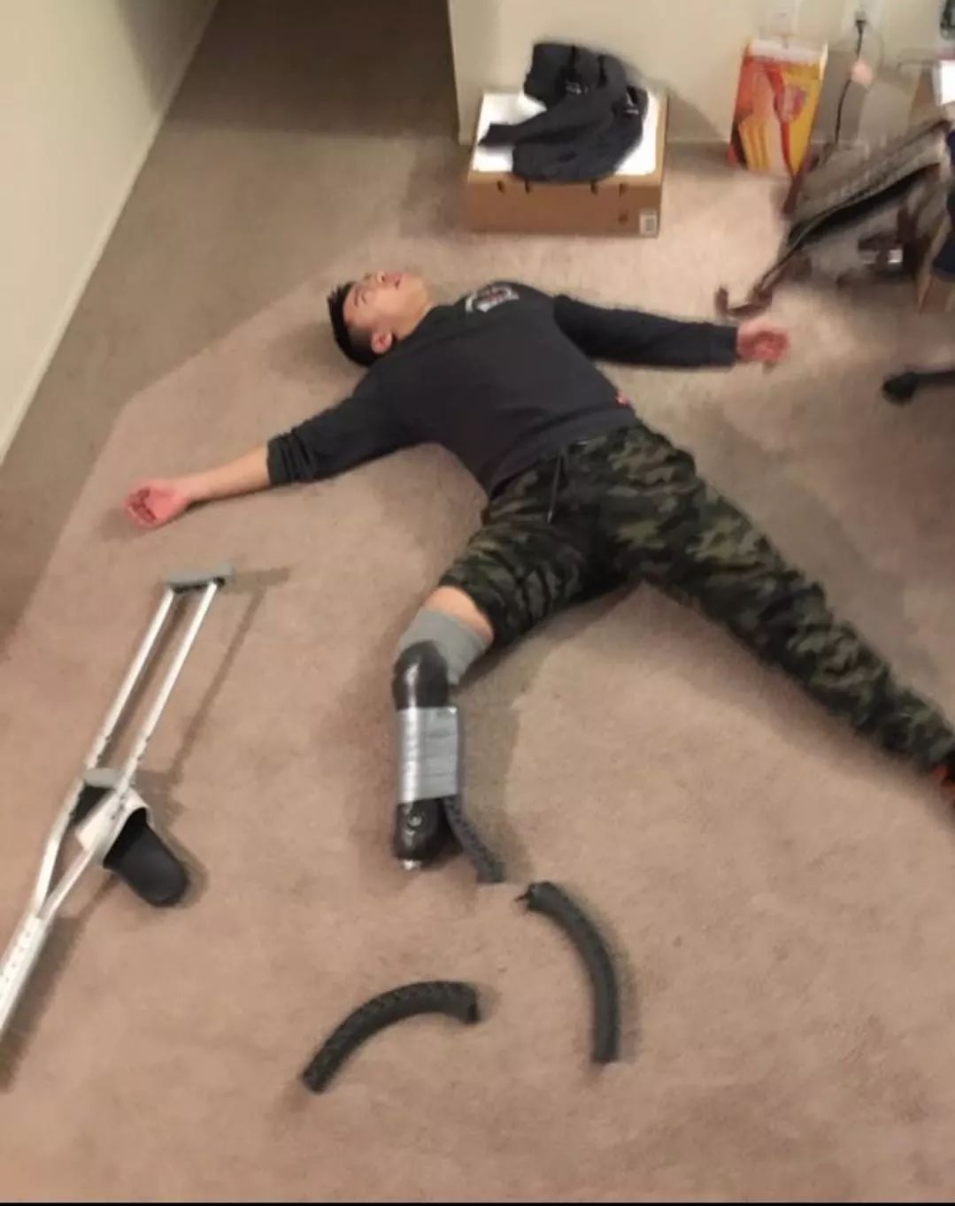 俄罗斯留学生骨折截肢,留学生意外被截肢