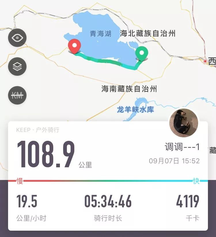 俄罗斯留学生骨折截肢,留学生意外被截肢