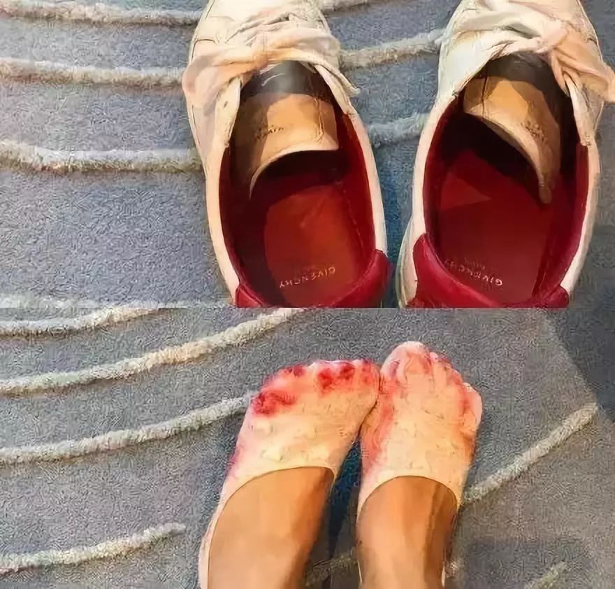 奢侈品包包褪色了怎么办,哪个奢侈品包包掉色