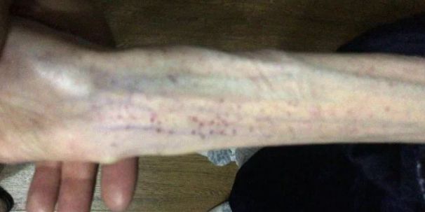 「新世相」高三女生3个月只吃黄瓜!出大事了!妈妈哭死:怎么劝都不听