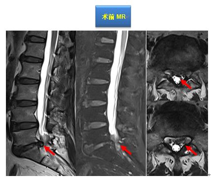 大连开发区筋骨堂正骨推拿,筋骨堂中医正骨推拿简介