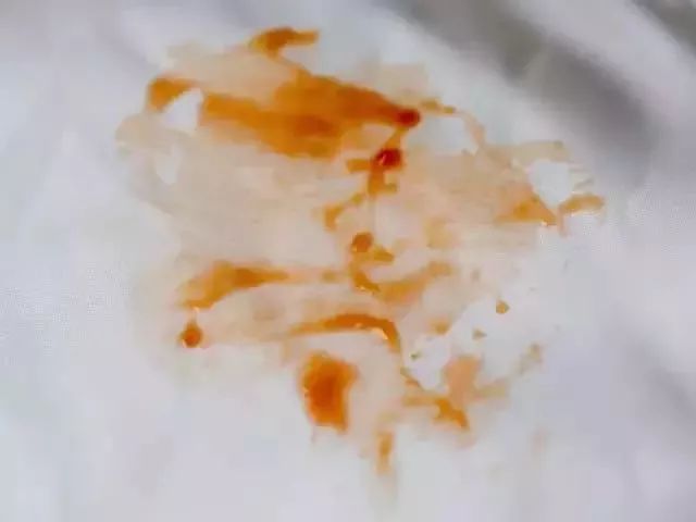 羽绒服脏了教你一招立刻变干净,羽绒服脏了怎么洗掉小窍门