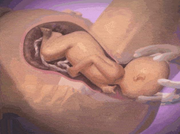 如何选择剖宫产还是顺产,顺产还是剖宫产到底怎么选