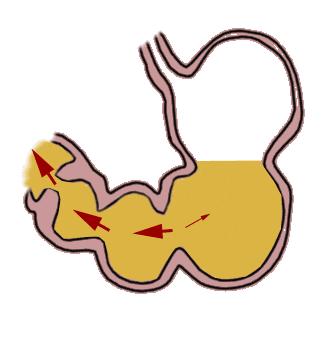 「快点医讯」家门口的福音：温州市消化道早癌筛查版图扩展！