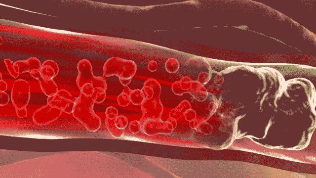 有了它睡眠才会更好,有了它可以让你每天多睡一小时