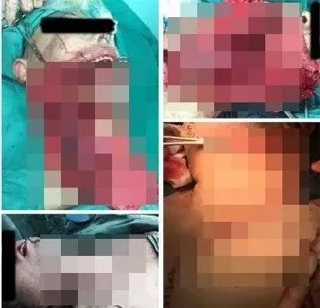 国家关于槟榔的最新消息,疯狂槟榔