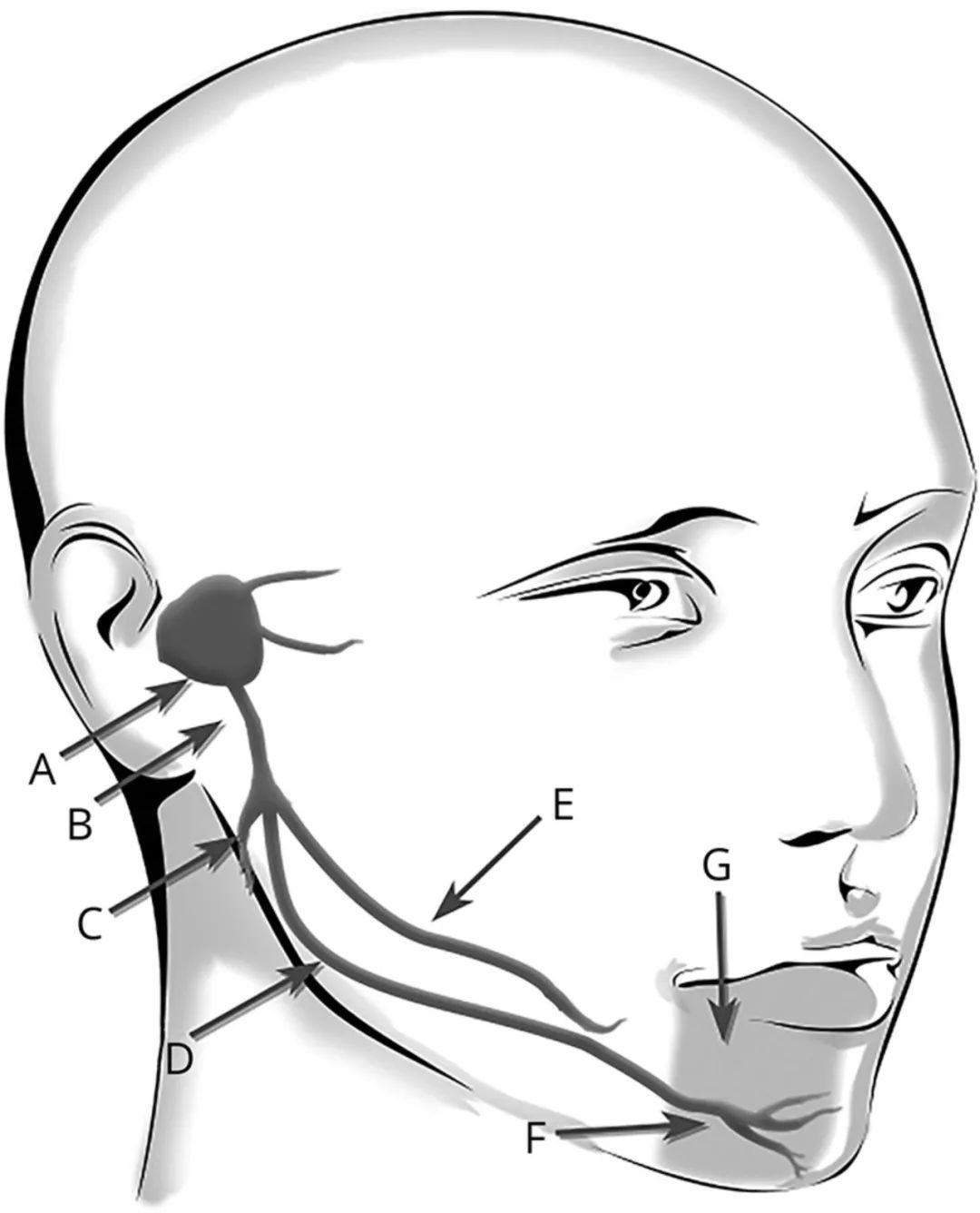 下巴发麻做什么检查,下巴麻木去医院挂什么科