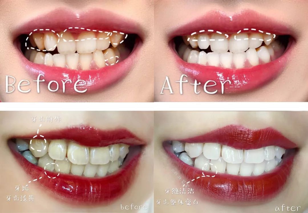 赵丽颖对霍建华是什么感觉,赵丽颖看霍建华的眼神