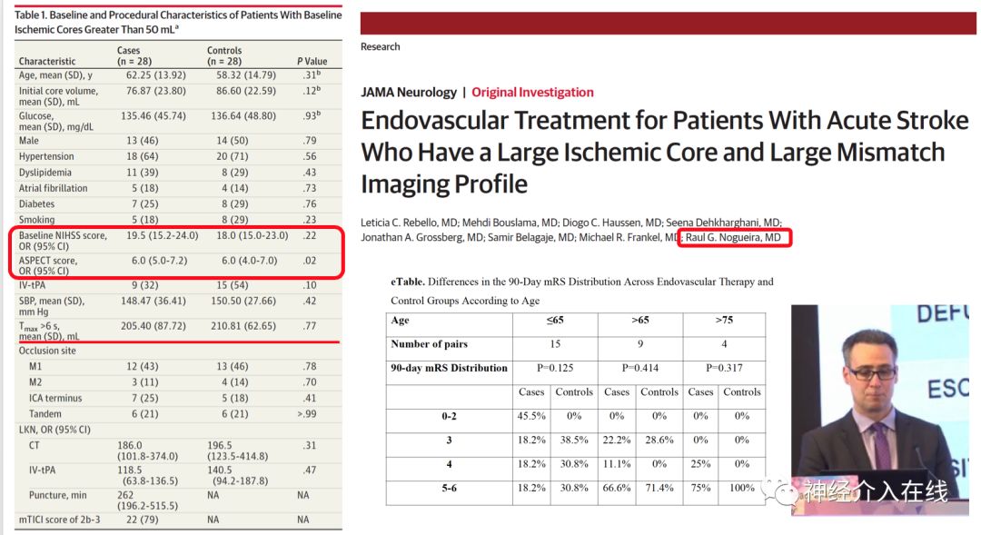 文献新萃·第六期|血管内治疗对大梗死核心患者是杯水车薪还是救命稻草？