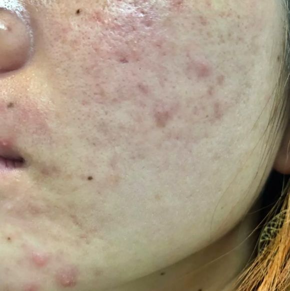 火山盐泥洗面奶,火山泥洗面奶与火山岩浆