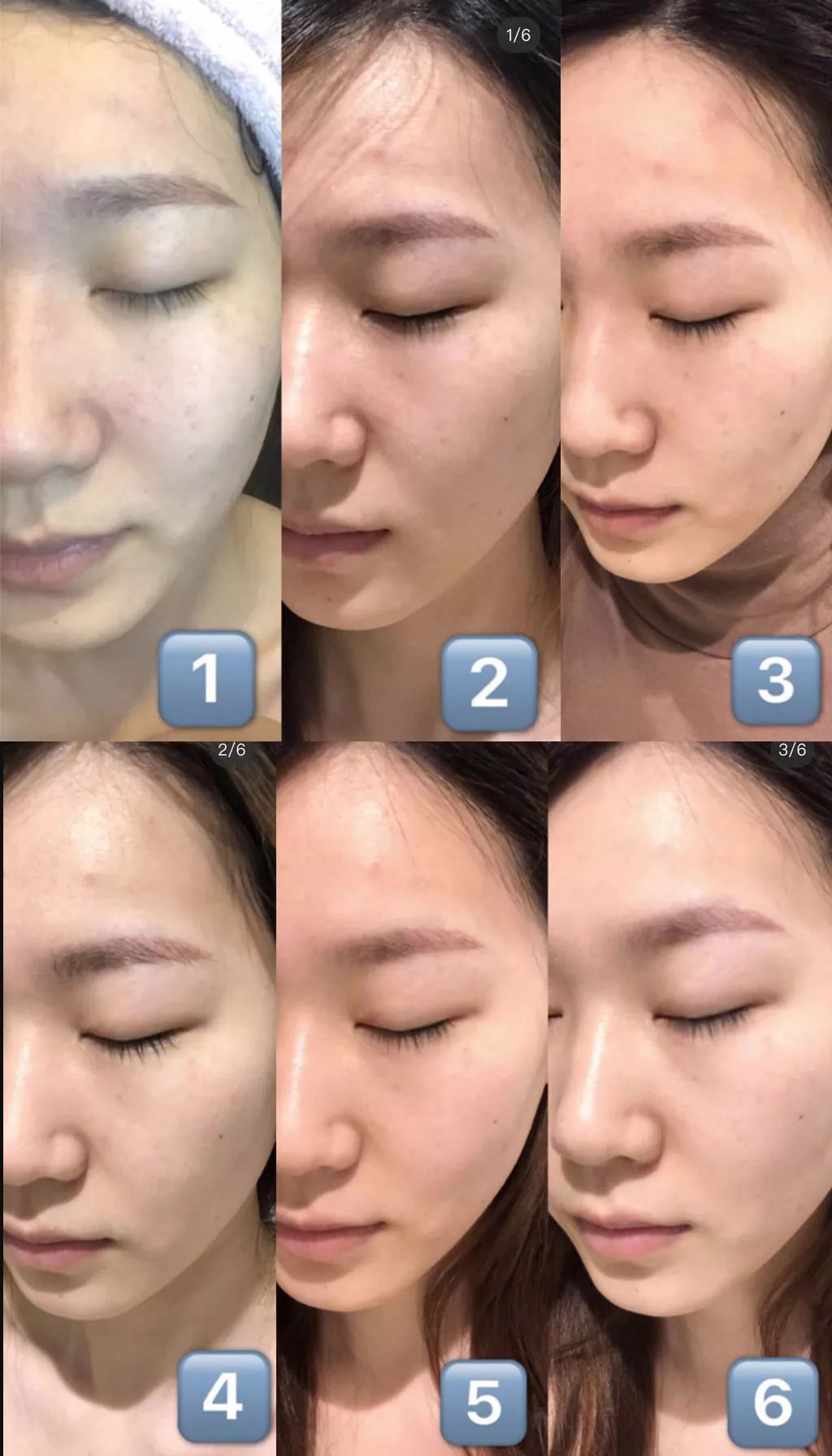 张嘉倪同款月光宝盒精华液,张嘉倪给人涂保湿美白精华液