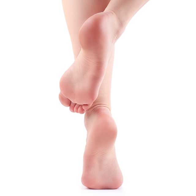 干裂的脚后跟有救了,脚后跟干裂起硬皮痒