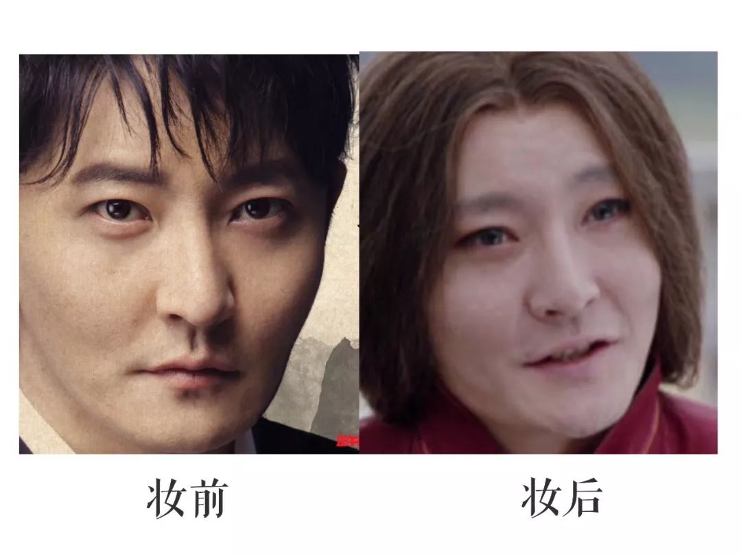 法令纹用一支玻尿酸够了没有,玻尿酸冻干眼纹贴