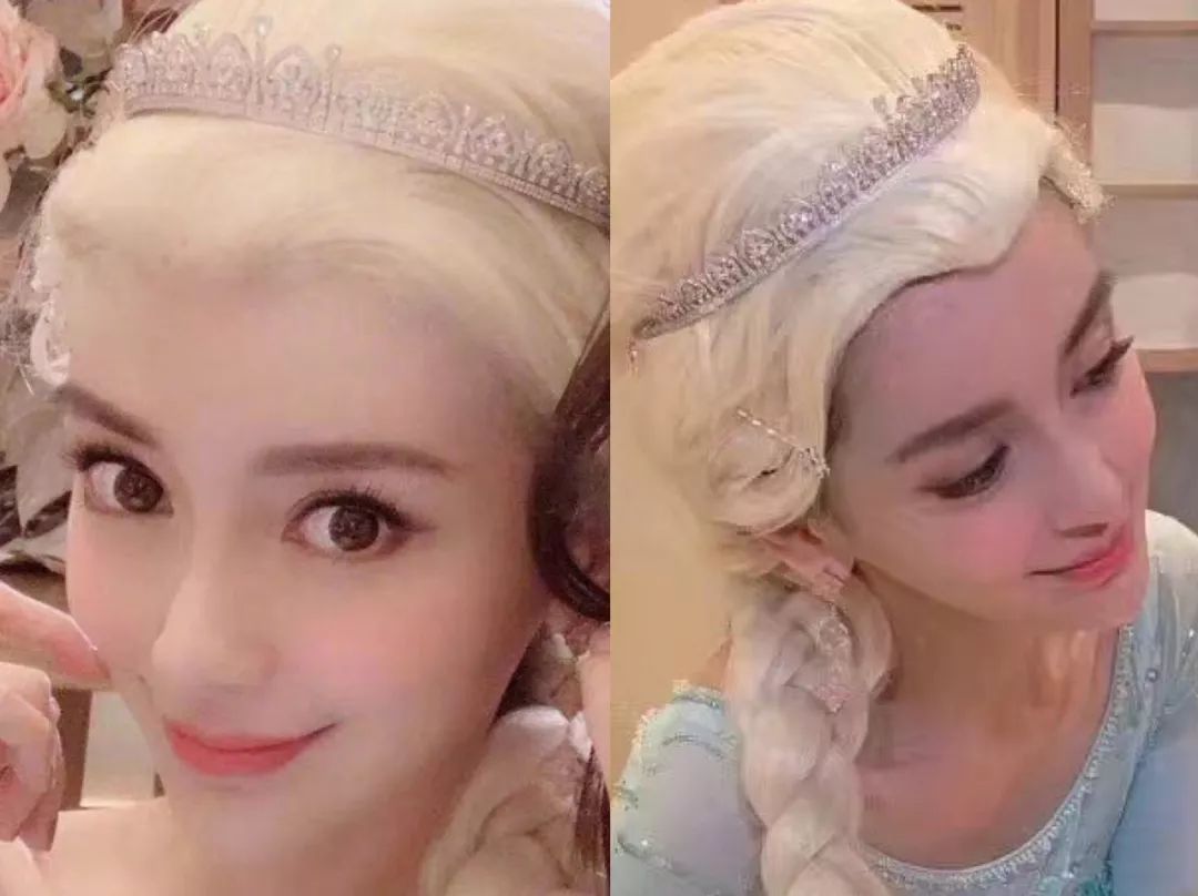 法令纹用一支玻尿酸够了没有,玻尿酸冻干眼纹贴