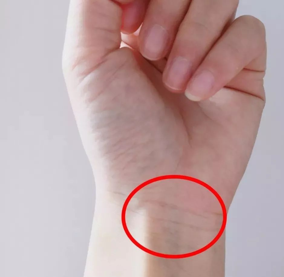 手上的青筋突然暴起代表什么意思,孩子吓到了手上有青筋是怎么回事