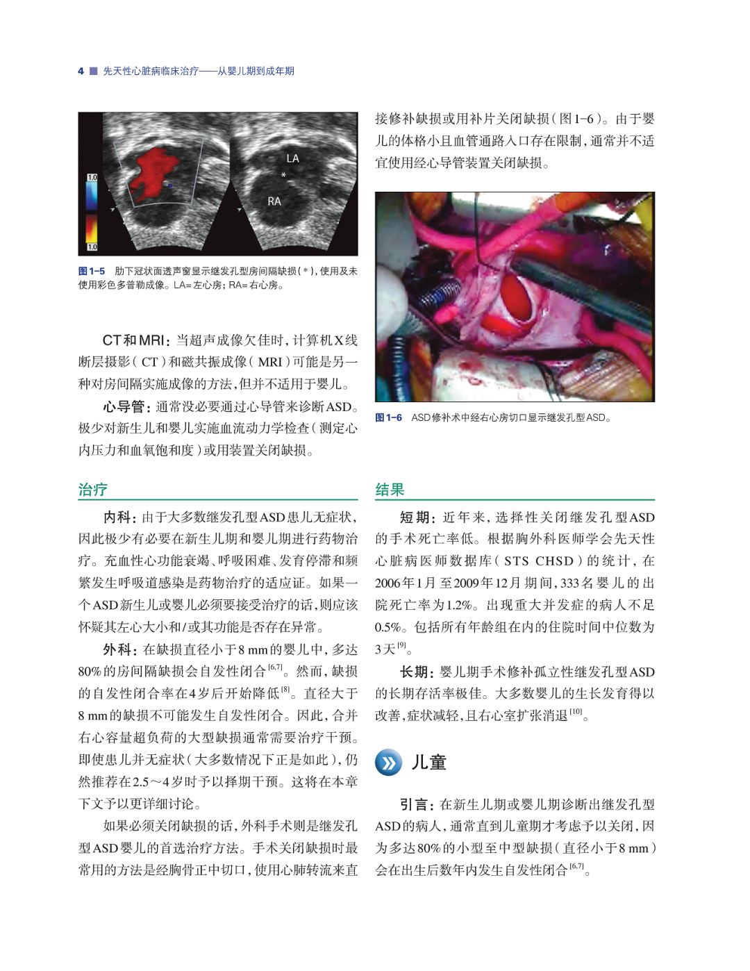 如何诊治先天性心脏病？看美国专家如是说