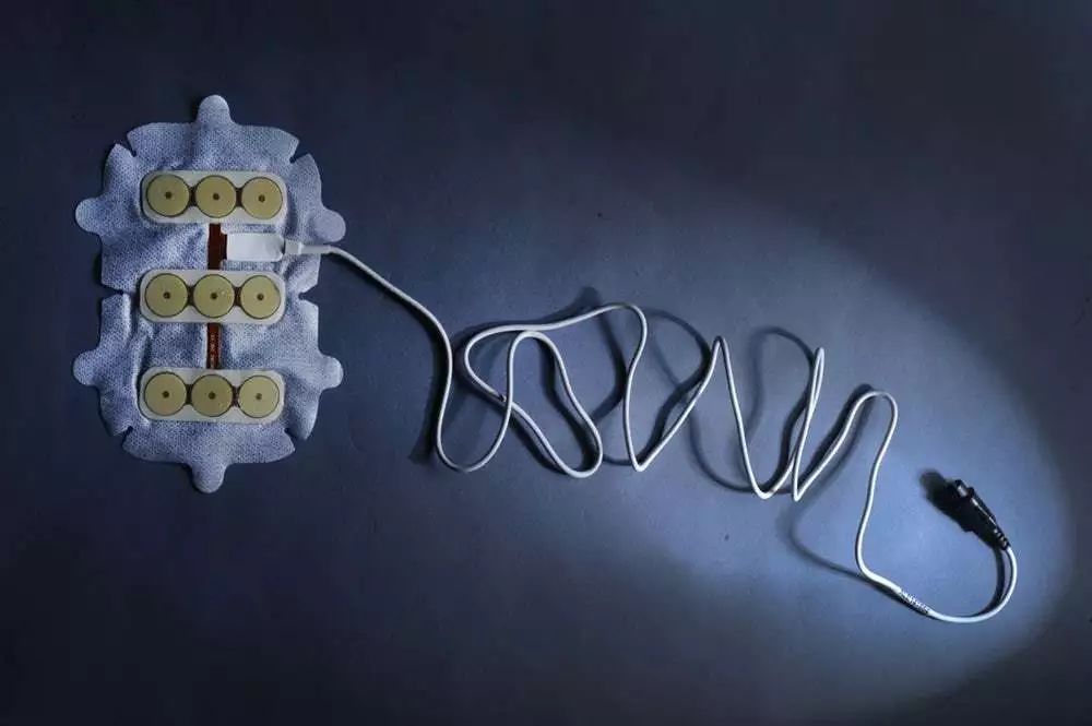 5年生存率翻番！这种全球范围内首次获批的电场抗癌黑科技，是脑部肿瘤治疗领域近10年来最大的突破丨奇点搜神记