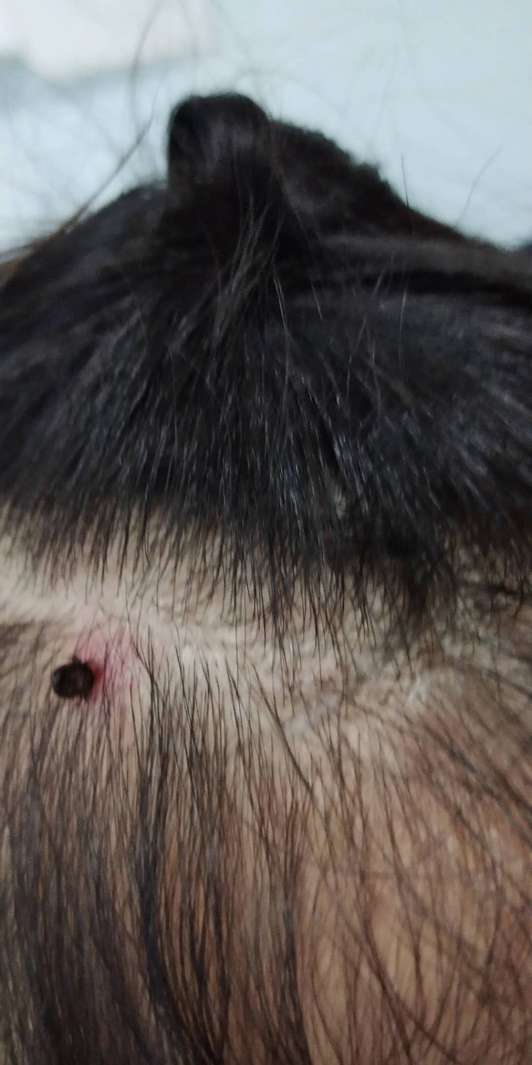 3岁女童头皮有红疙瘩一碰就疼,3岁女童头皮颜色黄怎么回事