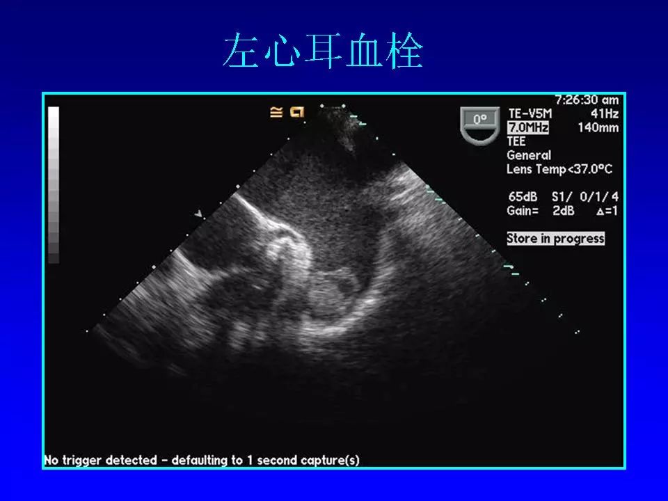 方丕华医生在哪个医院出诊,阜外方丕华出诊时间