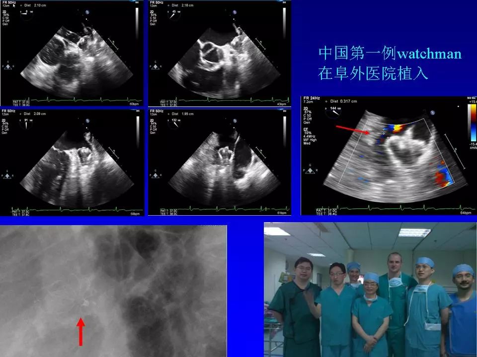 方丕华医生在哪个医院出诊,阜外方丕华出诊时间