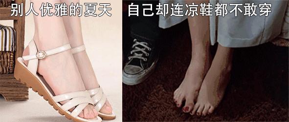 趾甲扎进肉里了，一碰就痛？用它一贴，1分钟止痛，趾甲往外长，再也不扎痛了！