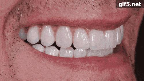 全城招募缺牙老人种牙不花冤枉钱,全城征集缺牙者均可报名免费种牙