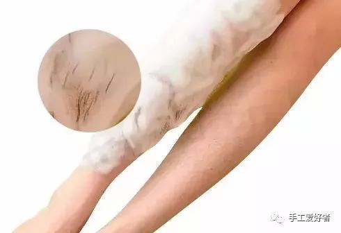 平价又好用的脱毛神器学生党温和,英国脱毛最好的产品适合学生党