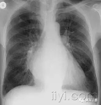 胸部解剖及常见疾病影像表现,胸部影像学基础知识