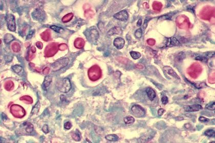 随手开个窗，女子竟染上了这种病...春天千万要当心！